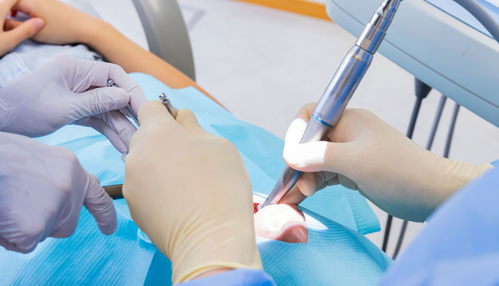 caries_04 https://otadentalclinic.com/wp-content/uploads/2025/09/caries_04.jpg